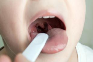 A child needs to have his tonsils removed and nasal polyp removed